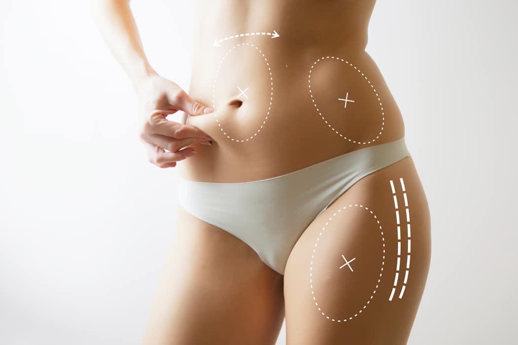 Conseils pour faire disparaitre la cellulite sur les fesses et cuisses