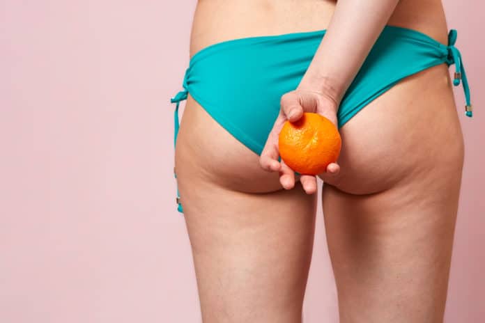 Conseils pour faire disparaitre la cellulite sur les fesses et cuisses