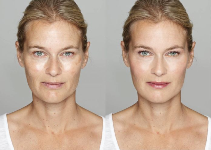Comment faire disparaitre les taches brunes sur le visage, mains etc... ? Comment faire disparaitre les taches brunes sur le visage, mains etc... ?