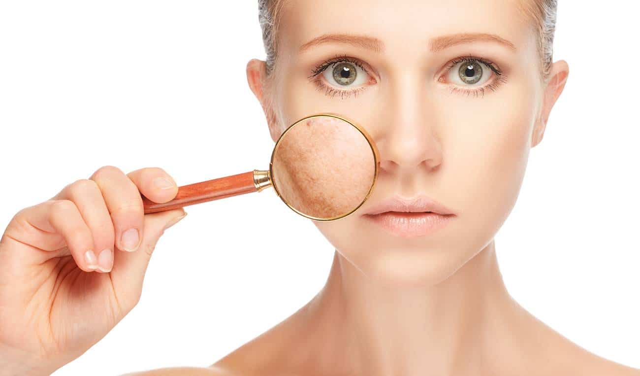Comment faire disparaitre les taches brunes sur le visage, mains etc... ?