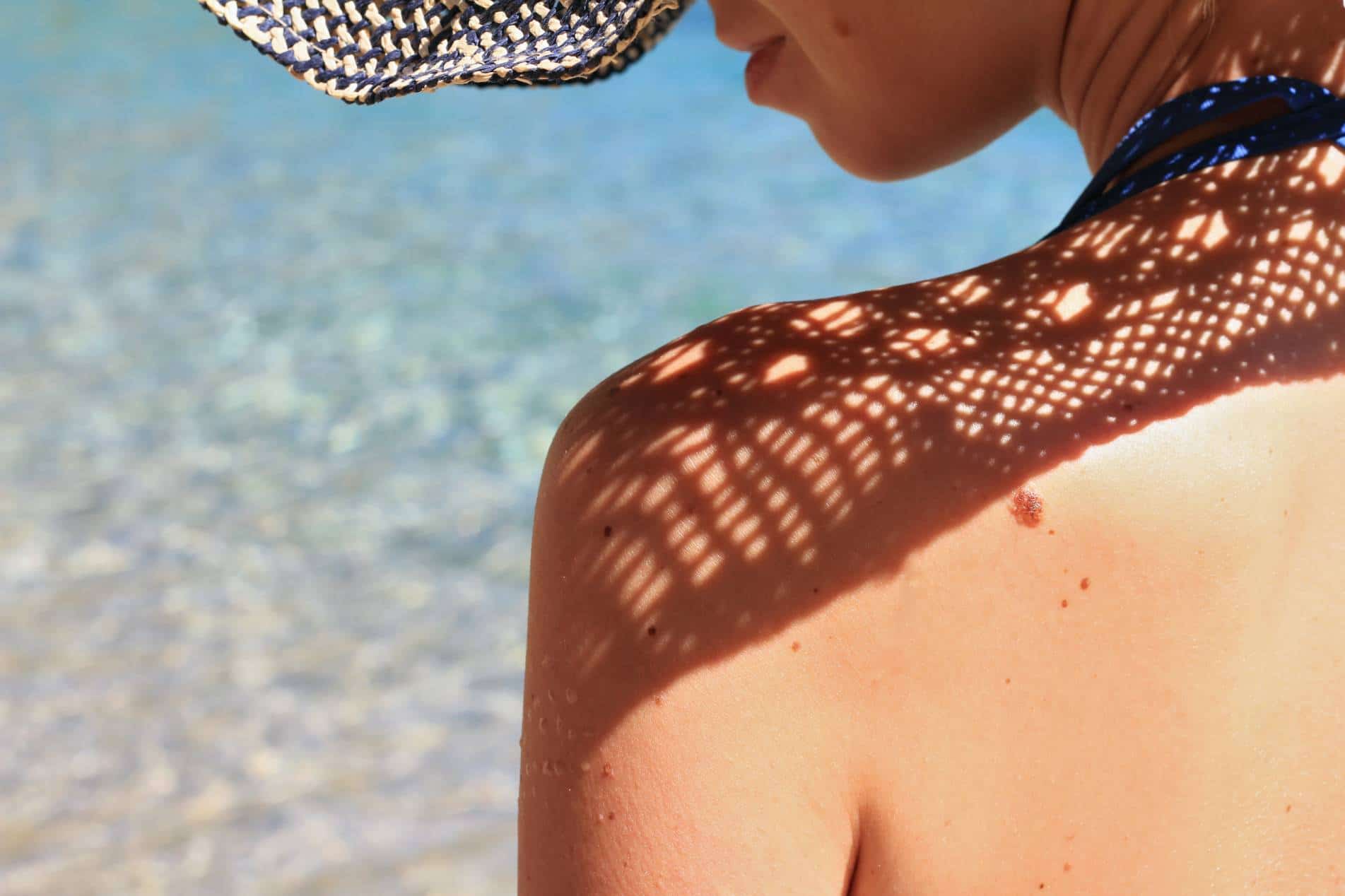 Comment faire disparaitre les taches brunes sur le visage, mains etc... ?