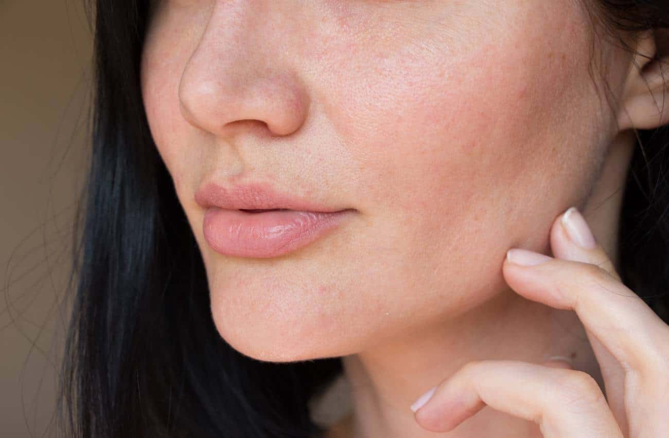 L'eau accentue les problèmes de sécheresse de peau : conseils et solutions
