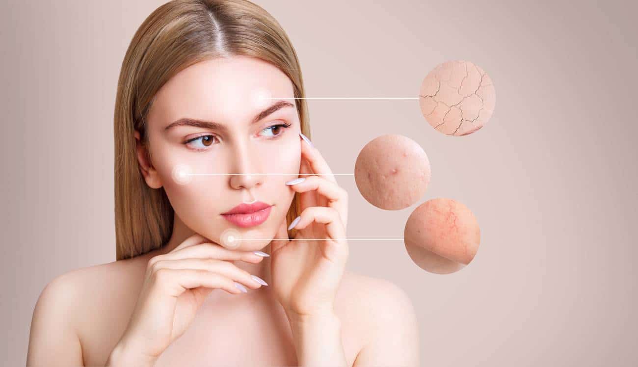 L'eau accentue les problèmes de sécheresse de peau : conseils et solutions