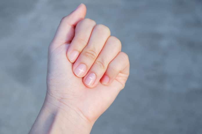ongles blancs 