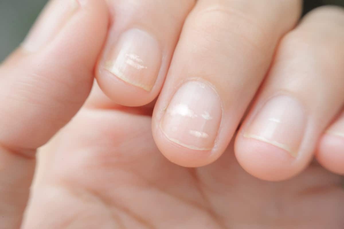 ONGLES BLANCS
