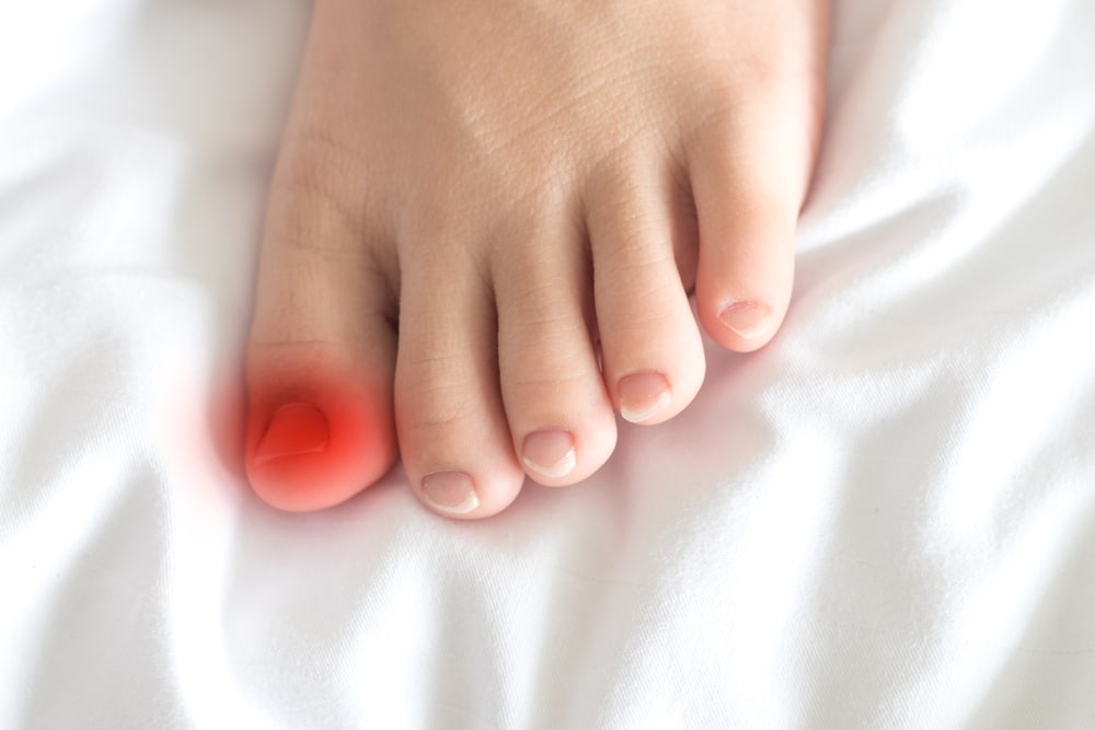 maladies des ongles