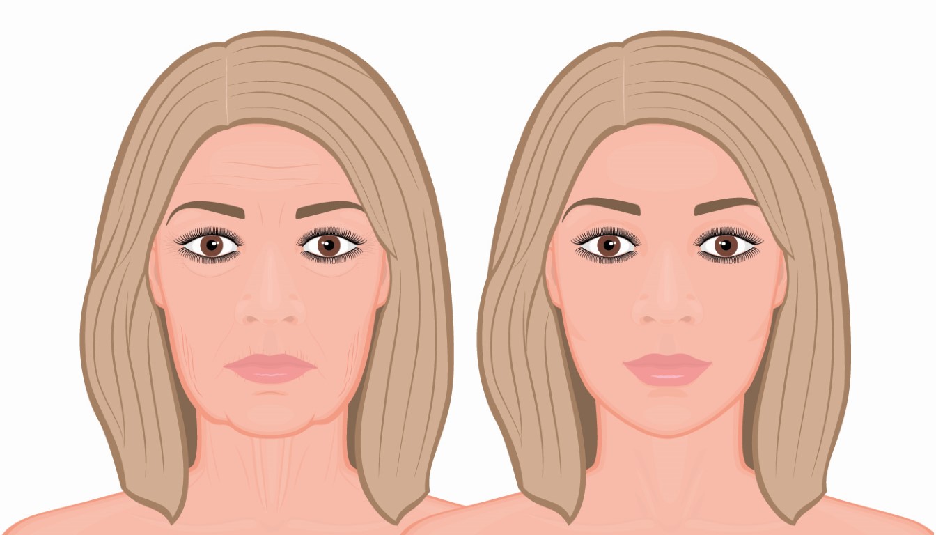 visage qui s'affaisse