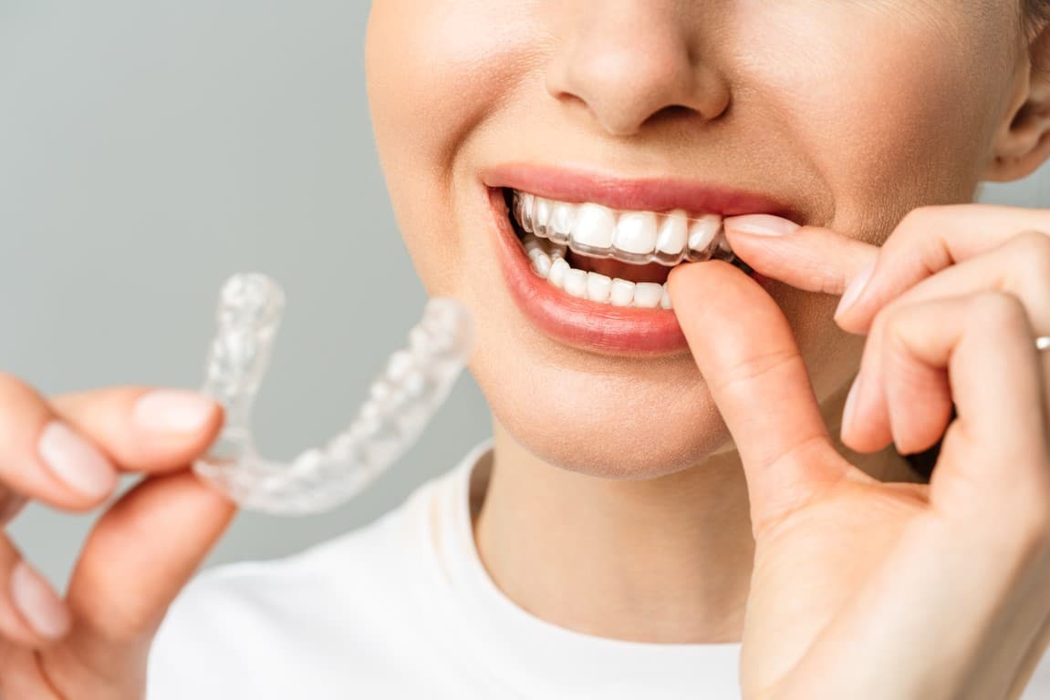 appareil pour se blanchir les dents