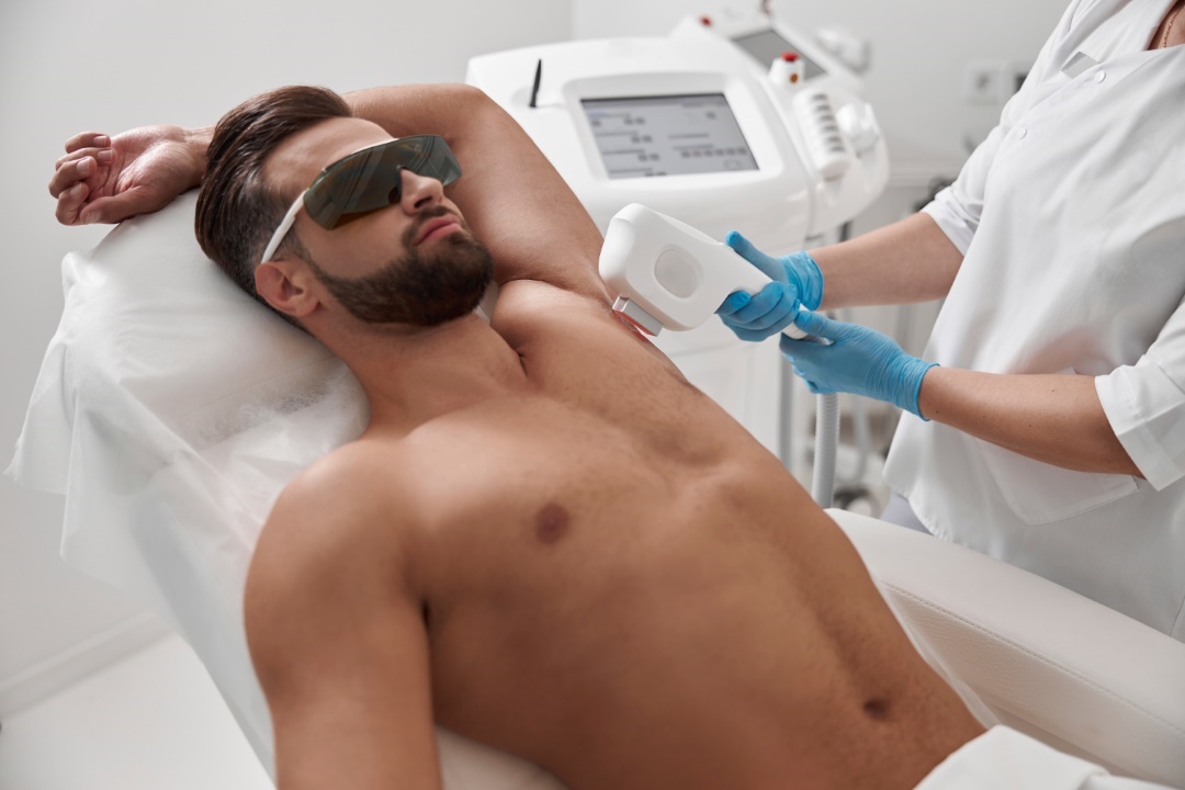 épilation laser innovation hommes